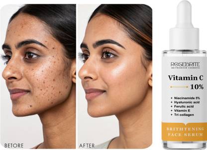 RoseBrite Vitamin C Glow & Guard Serum – Fights Dullness, UV Damage & Environmental Toxins Naturally