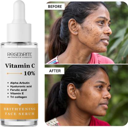 RoseBrite Daily Use Face Serum – Controls Excess Melanin, Fades Dark Spots, Sun Damage, Acne Marks & Improves Skin Brightness