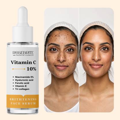 RoseBrite Anti-Wrinkle Face Serum – Vitamin C Infused to Firm Skin & Reduce Sagging Over Time