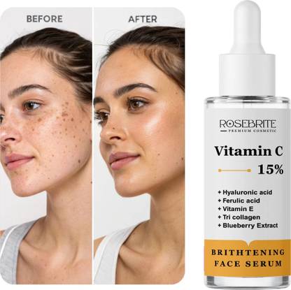 RoseBrite Vitamin C Face Serum with Vitamin E, Ferulic Acid & Hyaluronic Acid – Rebuilds Barrier, Fights Damage & Deeply Nourishes