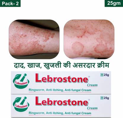 Lebrostone Ayurvedic Skin Care Treatment Cream 25g – For Ringworm, Itching & Fungal Infections (Pack of 2)