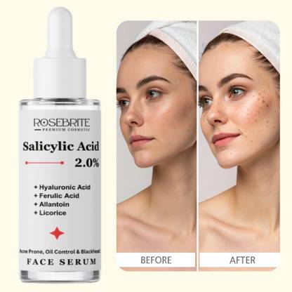 RoseBrite Hydrating Anti-Aging Serum – Salicylic Acid, Hyaluronic Acid, Allantoin & Licorice Smooth Fine Lines & Wrinkles