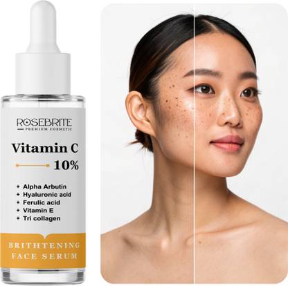 RoseBrite Spot Corrector Face Serum – Inhibits Melanin, Lightens Dark Spots, Acne Scars, and Uneven Skin Tone
