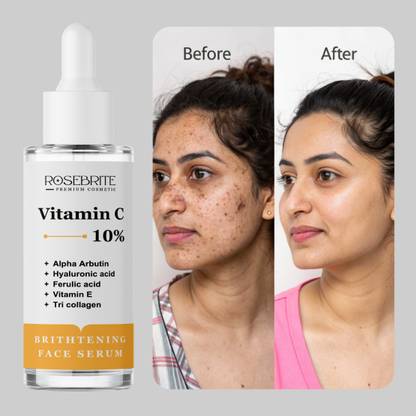 RoseBrite Best Brightening Vitamin C 10% Serum – Alpha Arbutin Infused for Dark Spot Correction & Youthful Glow