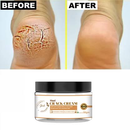 skivila Herbals Creak Cream With Clove And Sandal Oil