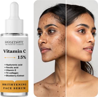 RoseBrite Vitamin C Brightening Face Serum – Fades Dark Spots, Evens Tone & Restores Skin Radiance