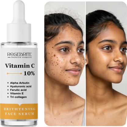 RoseBrite Professional Vitamin C Brightening Serum – Fades Dark Spots, Reduces Dullness & Restores Youthful Glow in 4 Weeks