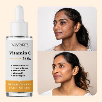 RoseBrite Vitamin C Serum for Face – Minimizes the Look of Pores, Boosts Skin’s Natural Glow & Improves Overall Skin Texture