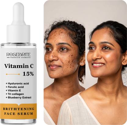 RoseBrite Vitamin C Serum – Improves Texture, Reduces Dark Spots, Boosts Glow & Promotes Even-Toned Skin