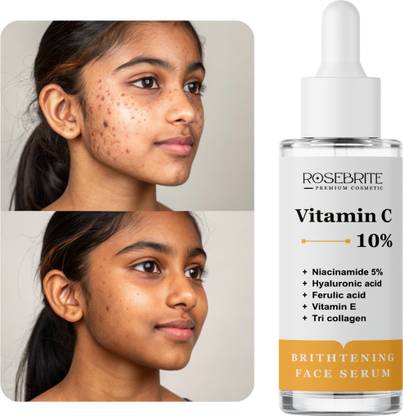 RoseBrite Vitamin C Serum – Evens Out Uneven Tone, Brightens Dull Skin & Fades Hyperpigmentation in Weeks