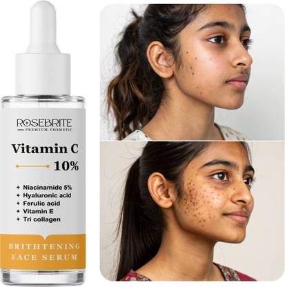 RoseBrite Multi-Corrective Face Serum – Vitamin C + Niacinamide + Hyaluronic Acid + Collagen + Vitamin E to Hydrate, Brighten & Firm Skin