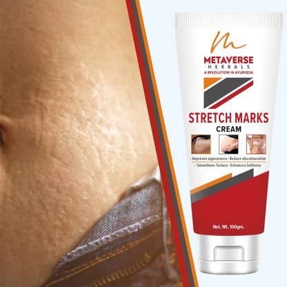 METAVERSE Stretch mark fading cream aids in reducing their visibility Under Arm Body Mark