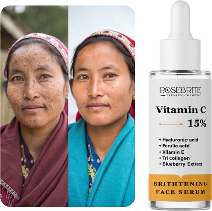 RoseBrite Vitamin C Serum for Face – Improves Skin Texture & Elasticity with Hyaluronic Acid, Ferulic Acid & Vitamin E for Glowing, Firm Skin