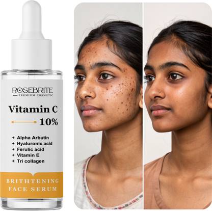 RoseBrite Vitamin C + Squalane Serum – Nourishes Dry Skin While Correcting Dark Spots & Improving Skin Clarity