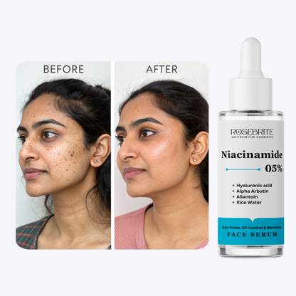 RoseBrite Face Serum That Deeply Hydrates and Visibly Firms Skin While Smoothing Out Wrinkles and Fine Lines