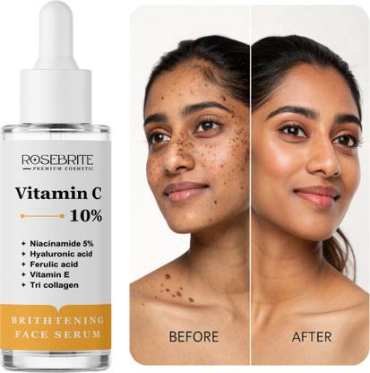 RoseBrite Daily Glow Vitamin C Serum – With Niacinamide, Collagen & HA to Even Tone, Smooth Skin & Reduce Lines