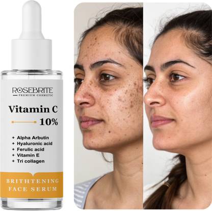 RoseBrite Vitamin C Skin Repair Serum – Fights Pigmentation, Sun Damage & Dullness to Help You Achieve a More Radiant Complexion