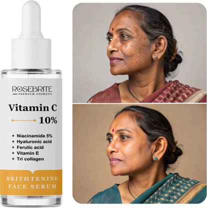 RoseBrite Vitamin C + Tri-Collagen Serum – Boosts Radiance, Fades Pigmentation & Hydrates Skin with Niacinamide & HA