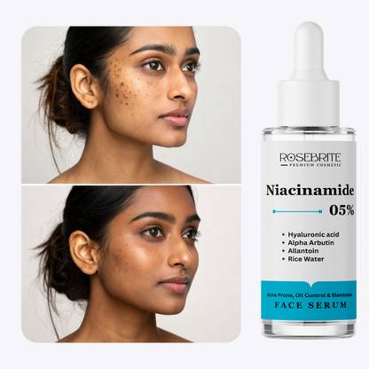 RoseBrite Niacinamide 5% Daily Skin Serum with Alpha Arbutin & HA for Brighter, Clearer, More Even Skin Tone & Texture