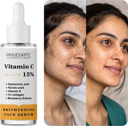 RoseBrite Vitamin C Brightening Face Serum – Fades Dark Spots, Evens Skin Tone, Boosts Radiance & Improves Skin Texture