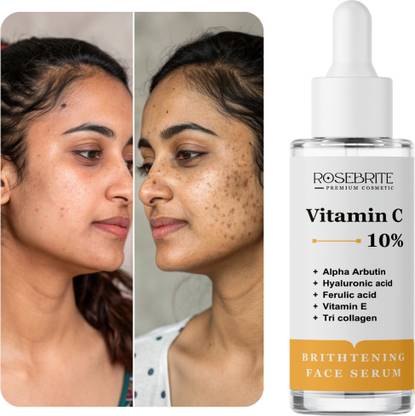 RoseBrite Dermatologist-Endorsed Vitamin C Face Serum – Visibly Brightens, Firms & Nourishes All Skin Types