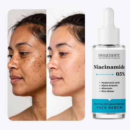RoseBrite Glow-Boosting Face Serum with 5% Niacinamide, Alpha Arbutin and Hyaluronic Acid for Smooth, Youthful-Looking Skin