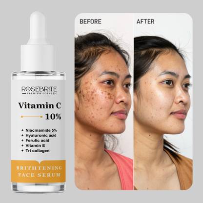 RoseBrite Vitamin C Facial Serum – Refines Pores, Brightens Skin & Restores Healthy Radiance with Lightweight Hydration