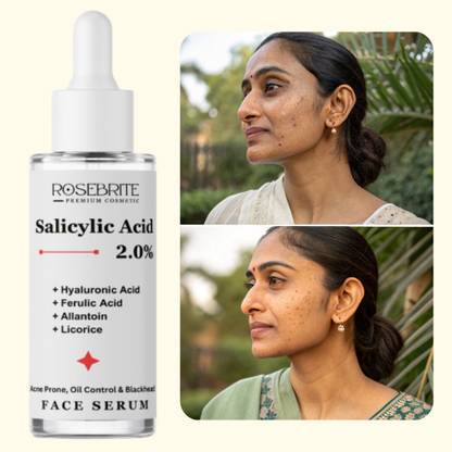 RoseBrite Pore-Clearing Serum – Salicylic Acid, Ferulic Acid & Allantoin Reduce Acne, Blackheads, Whiteheads & Redness