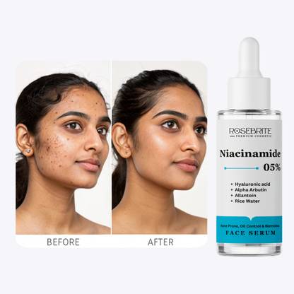 RoseBrite Rejuvenating Brightening Serum – Anti-Aging Formula to Lighten Dark Spots, Smooth Texture & Enhance Radiance