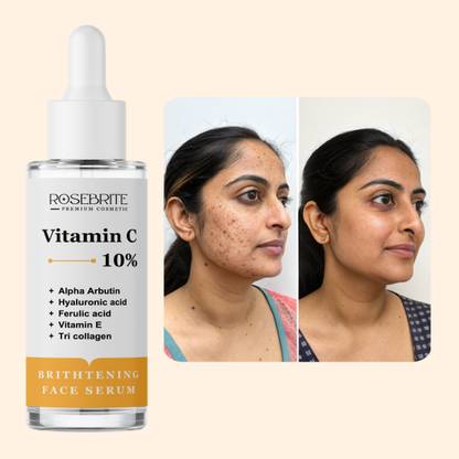 RoseBrite Natural Face Serum – Fades Discoloration, Acne Marks & Melanin Spots Without Irritation