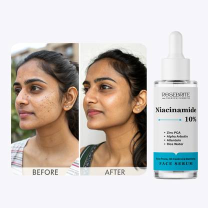 RoseBrite Balancing Face Serum – Minimizes Pores, Fades Blemishes & Improves Texture Without Stripping Skin Moisture