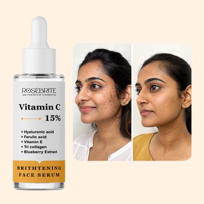 RoseBrite Advanced Vitamin C Serum – Evens Skin Tone, Boosts Glow & Hydration – With Ferulic Acid, Vitamin E & Hyaluronic Acid