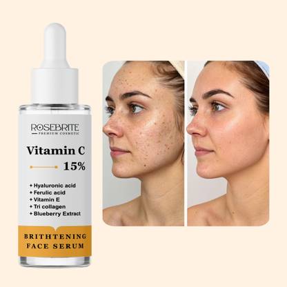 RoseBrite Vitamin C Radiance Serum – Smooths, Hydrates & Fades Pigmentation with Powerful Antioxidants & Skin Boosters