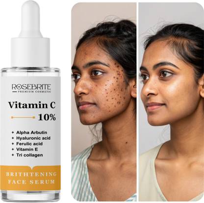 RoseBrite Brightening & Even Tone Serum – With Vitamin C to Fade Dullness, Pigmentation & Spots