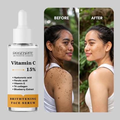 RoseBrite Brightening Vitamin C Serum – Enhances Glow, Smooths Skin & Reduces Fine Lines