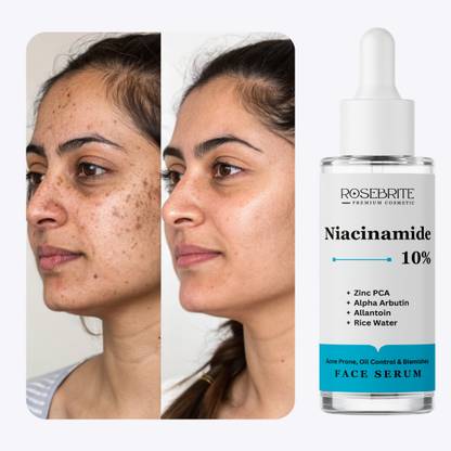 RoseBrite Oil-Regulating Face Serum – With Niacinamide & Alpha Arbutin to Improve Tone & Fade Acne Discoloration