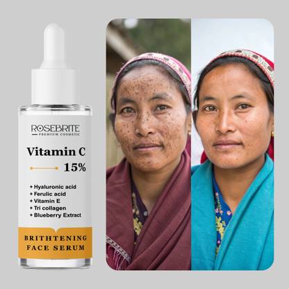 RoseBrite Advanced Vitamin C Serum – Brightens Skin, Reduces Spots & Improves Skin Tone