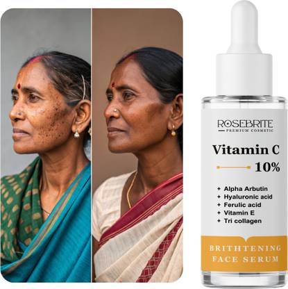 RoseBrite Vitamin C Face Serum to Even Out Skin Tone, Hydrate Deeply & Minimize Aging Signs with Natural Extracts