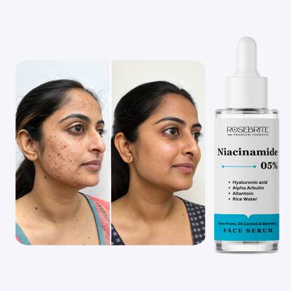 RoseBrite Deep Hydration Face Serum That Plumps Skin, Reduces Fine Lines, and Restores Youthful Elasticity with Active Botanical Extracts