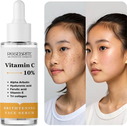 RoseBrite Face Serum for Spot-Free Skin – Fades Acne Discoloration, Sun Spots & Regulates Melanin Activity