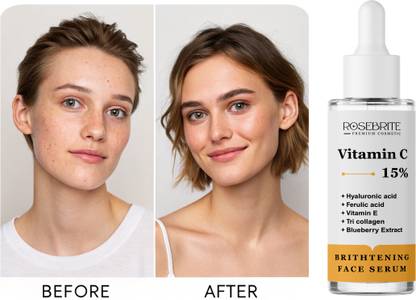 RoseBrite Vitamin C 15% Serum – Reduces Wrinkles, Hydrates & Boosts Skin Texture with Hyaluronic Acid, Ferulic Acid & Vitamin E