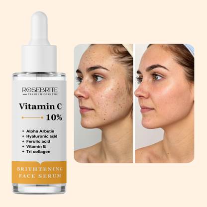 RoseBrite Vitamin C + Skin Brightening Serum – Reduces Excess Melanin, Erases Acne Scars & Sun Spots for Clear Skin