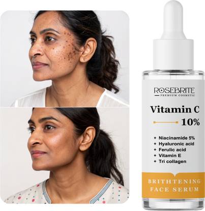 RoseBrite Vitamin C Glow Serum – Helps Fade Hyperpigmentation, Reduces Dullness & Boosts Skin Brightness With Regular Use