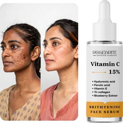 RoseBrite Radiant Glow Vitamin C 15% Serum – With Vitamin E, Ferulic & Hyaluronic Acid – Brightens, Firms & Moisturizes Skin
