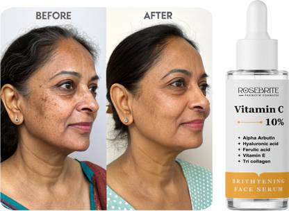 RoseBrite Even Skin Tone Vitamin C Serum – Fades Pigmentation, Promotes Renewal & Softens Skin Without Irritation