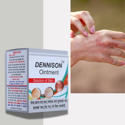 RAHIPA Dennison Malam for Ringworm,itching, Burn Mark