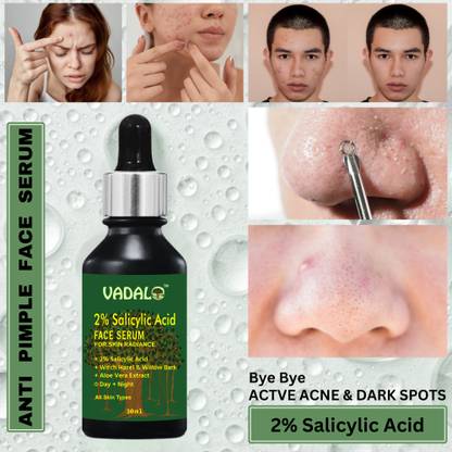 Vadalo | 2% Salicylic Acid Serum with Witch Hazel & Willow Bark for Active Acne |