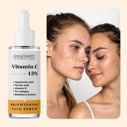 RoseBrite Radiant Glow Vitamin C Face Serum – Fights Pigmentation & Evens Skin Tone Gently