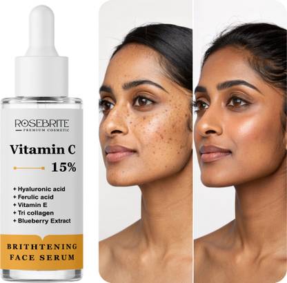 RoseBrite Daily Glow Vitamin C Face Serum – Fights Pigmentation, Dullness & Uneven Skin Tone