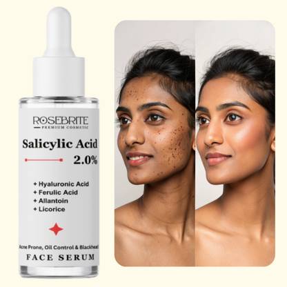 RoseBrite Salicylic Acid Serum for Acne-Prone Skin – Unclogs Pores, Exfoliates Dead Skin & Reduces Blackheads & Whiteheads